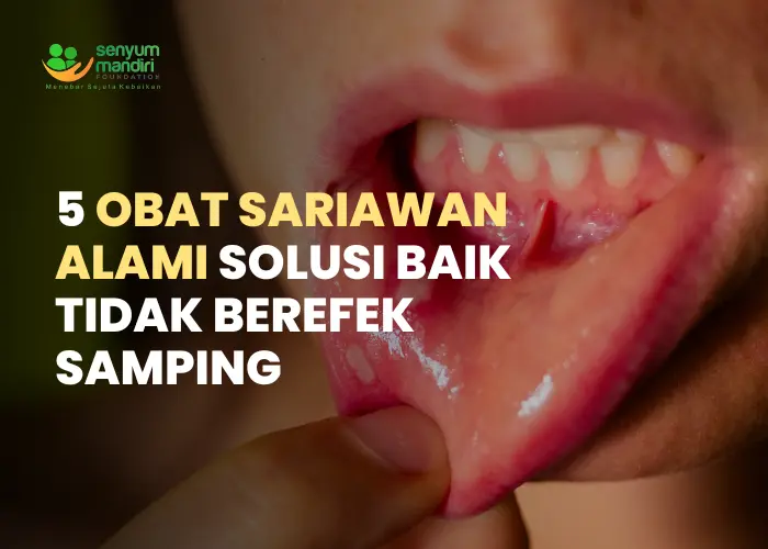 Obat Sariawan Alami